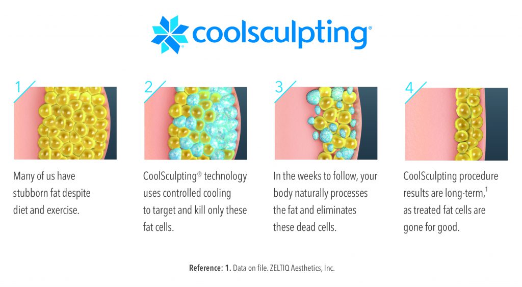 How Coolsculpting Works - Vibe MediSpa in Bedford NS